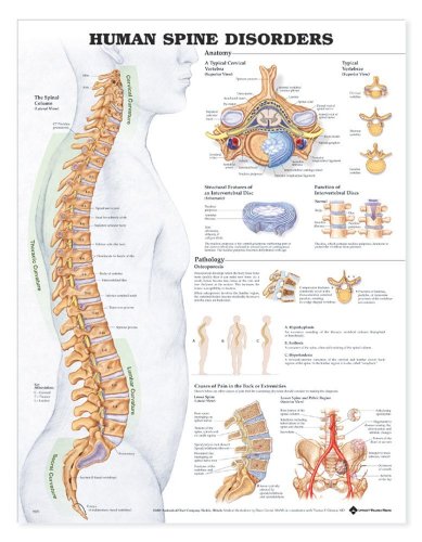 Poremećaji ljudske kralježnice Anatomska grafikon